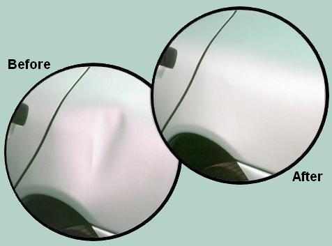 Auto Body Dent Repair